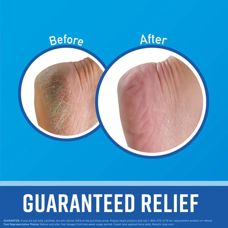 O’Keeffe’s - Healthy Feet Cream